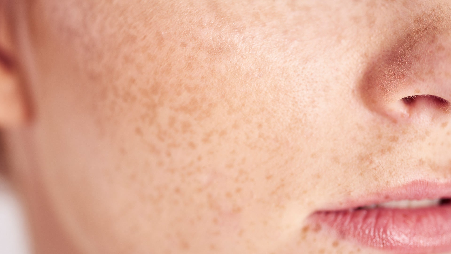 How do you cure facial redness overnight?