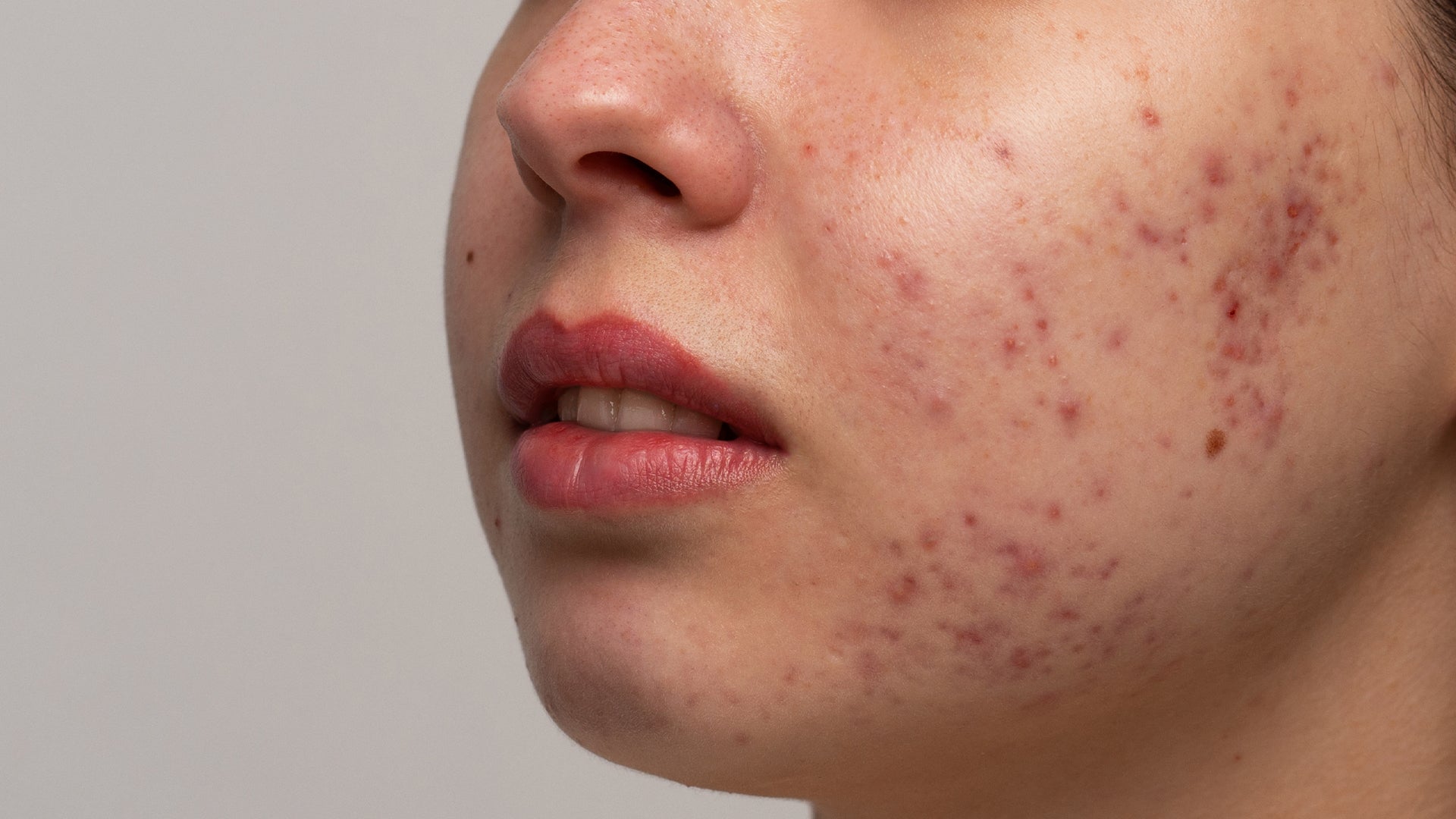 Skin inflammation discount