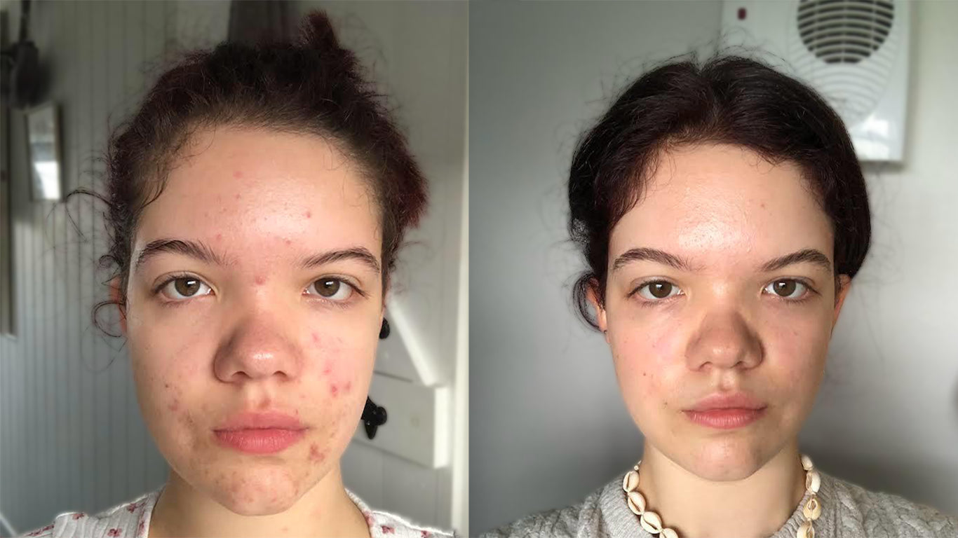 How the Recovery & Repair Gel Changed My Life - Martha’s Story