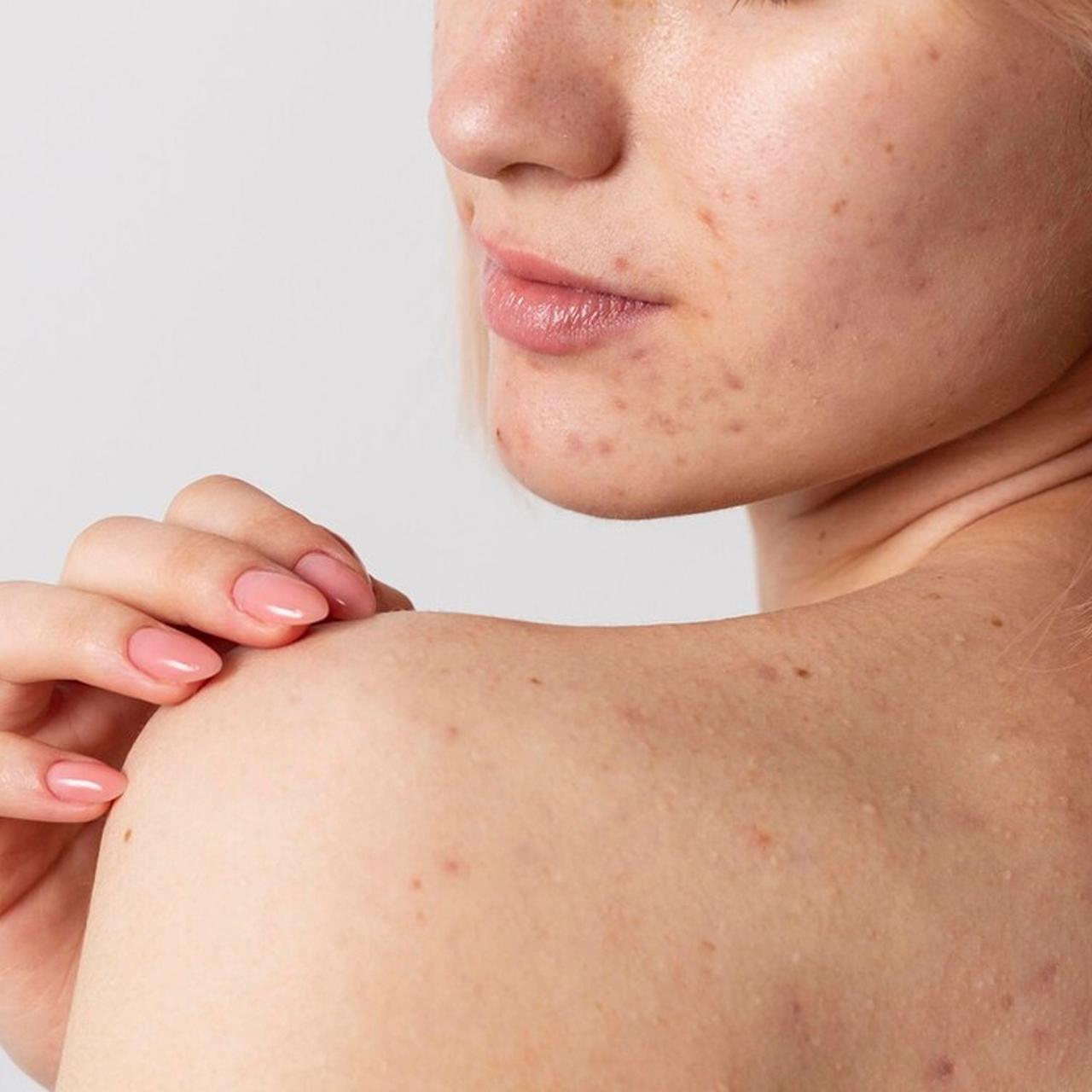 What causes skin inflammation on the face Seacra Skincare
