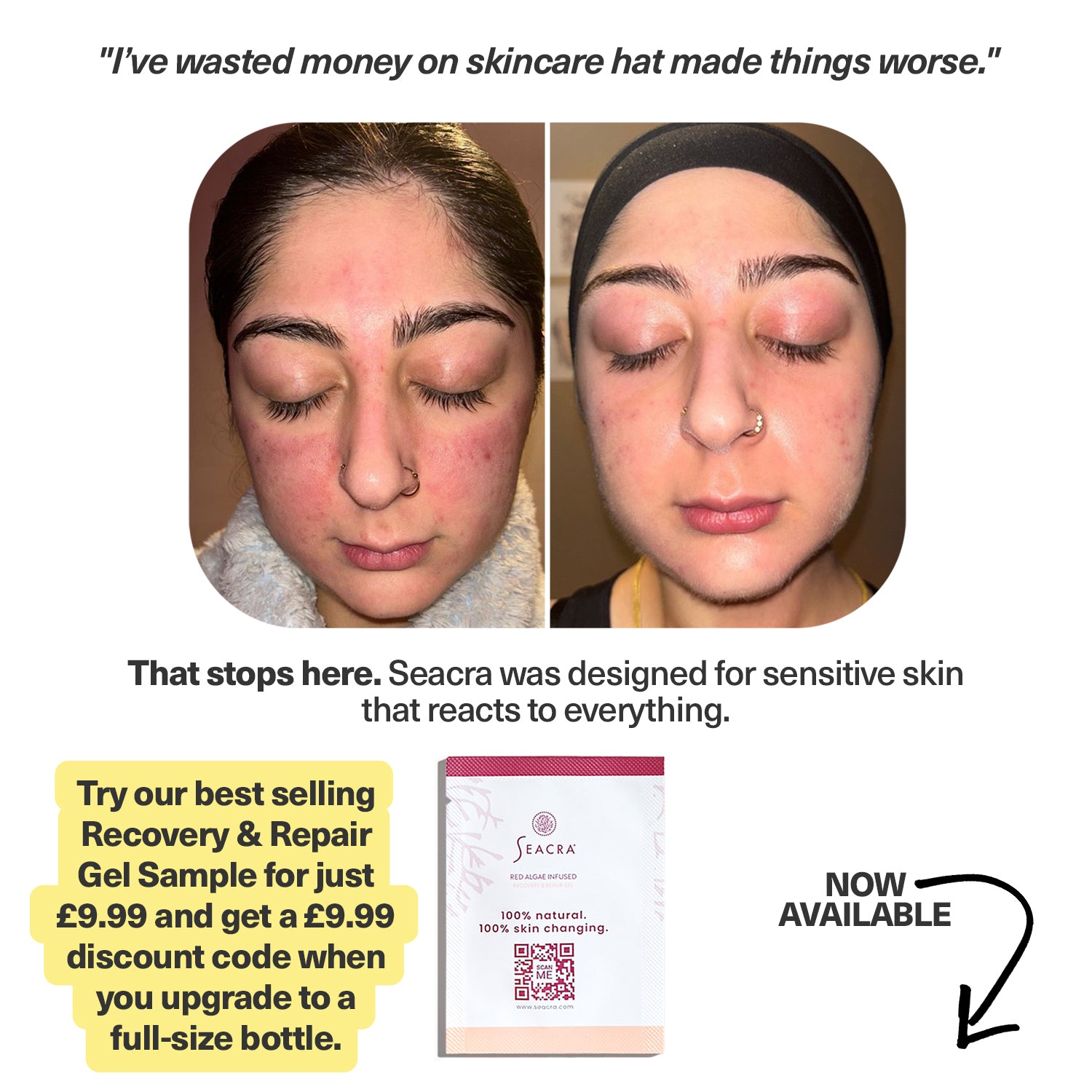 Red Algae Recovery & Repair Gel Sample