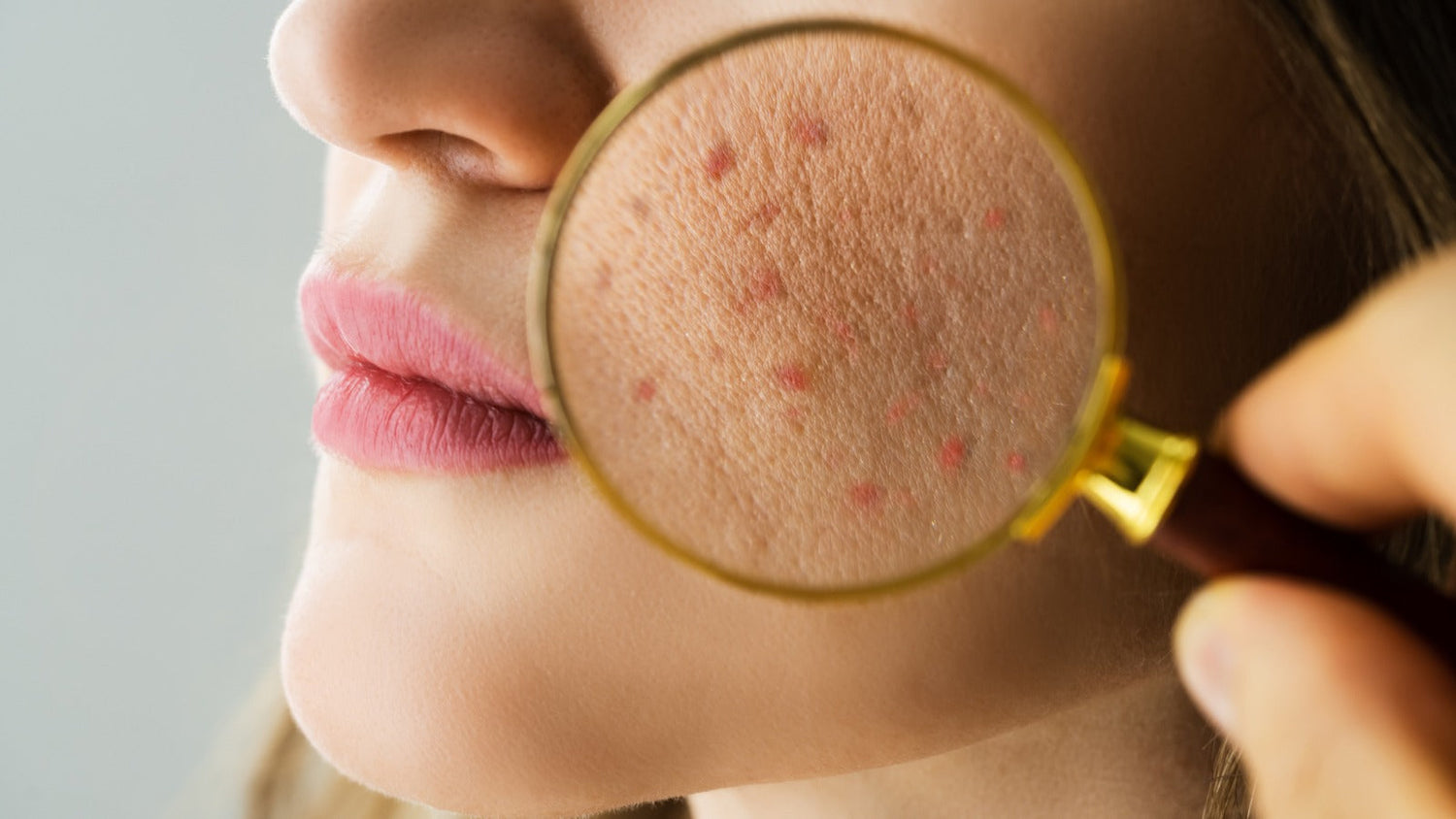 The Skin Barrier: Everything You Need to Know (and How to Repair It)