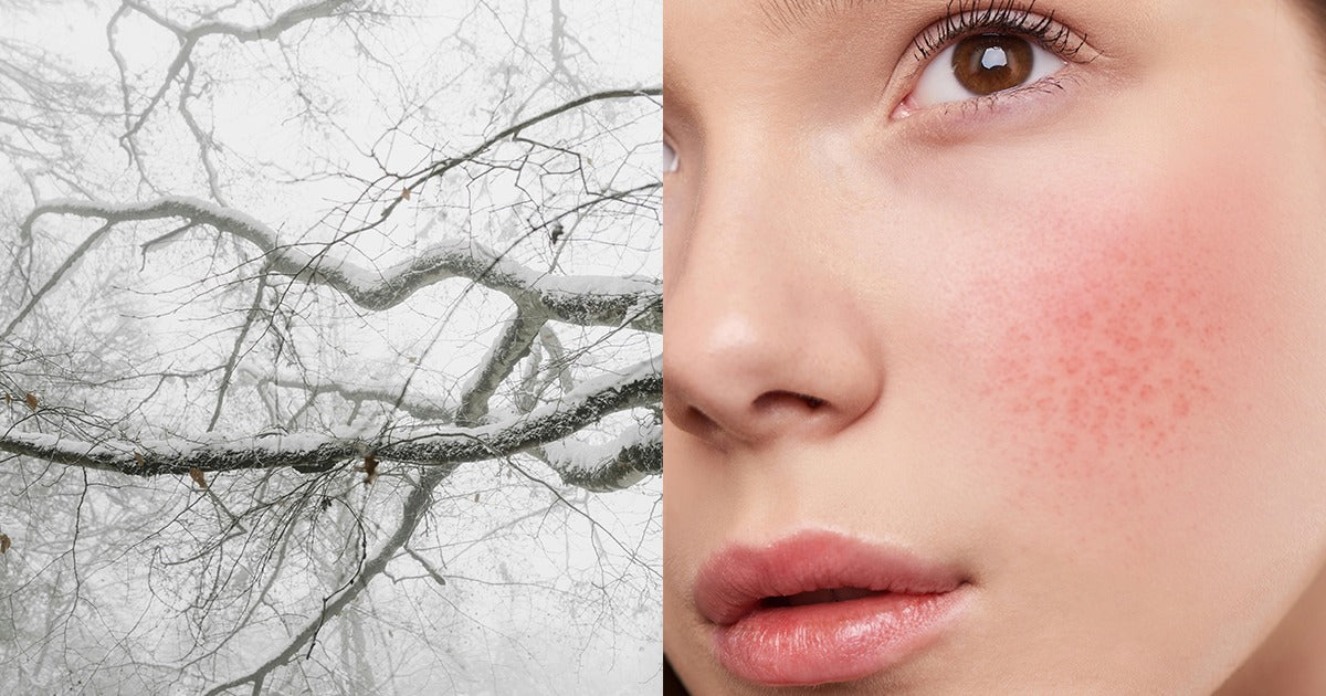 What Happens to Your Skin After Winter
