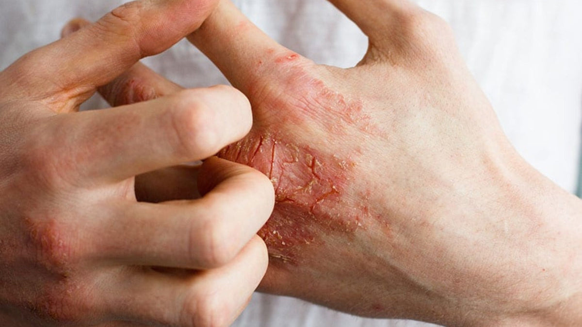 Serria Rash April Is Here… And We Have Something Special for You! – Seacra Skincare