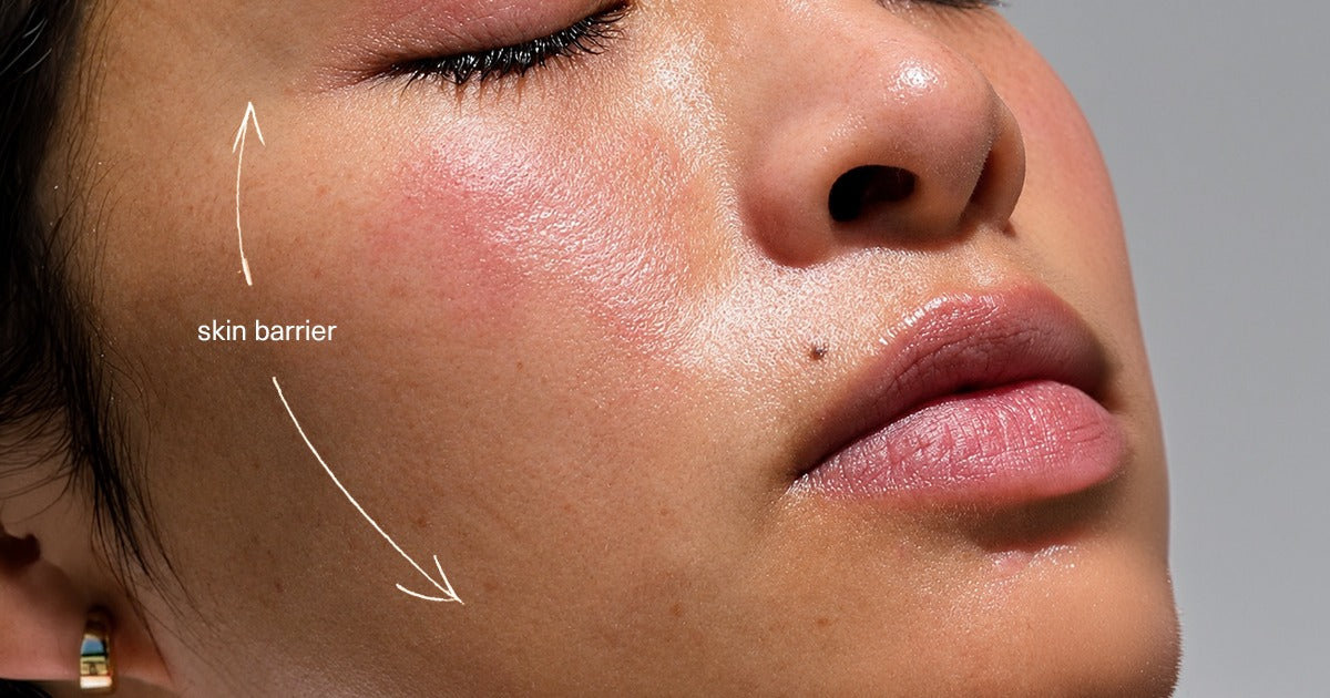 Build Your Barrier Before Winter Does the Damage: A 14-Day Pre-Flare Plan for Red, Reactive Skin