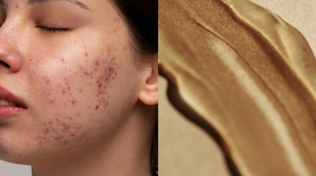 How to get rid of redness on face — Seacra Skincare