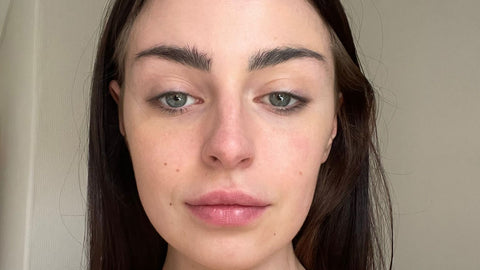 Calmer skin after Seacra