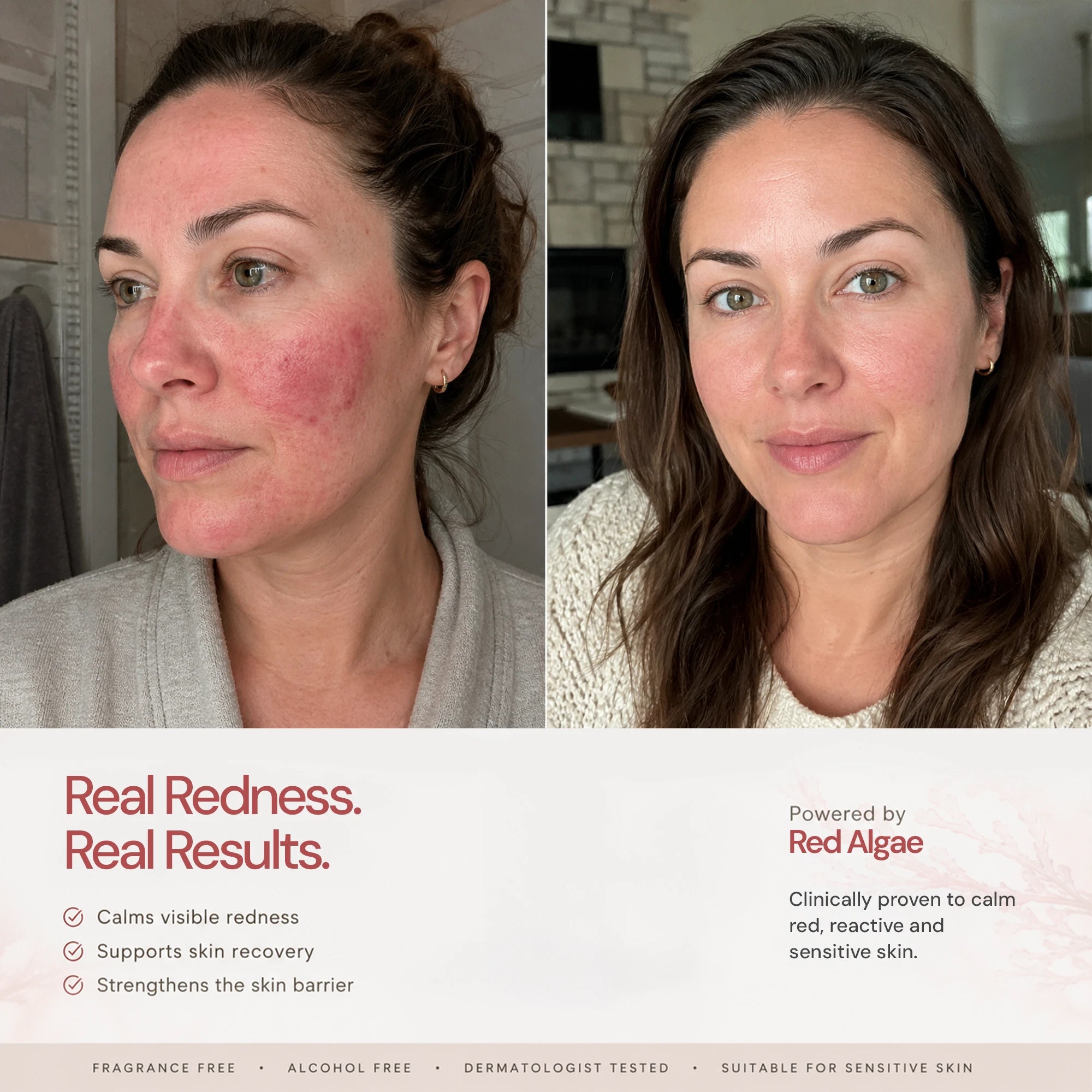 Before and after using Seacra Red Algae Gel for visible facial redness